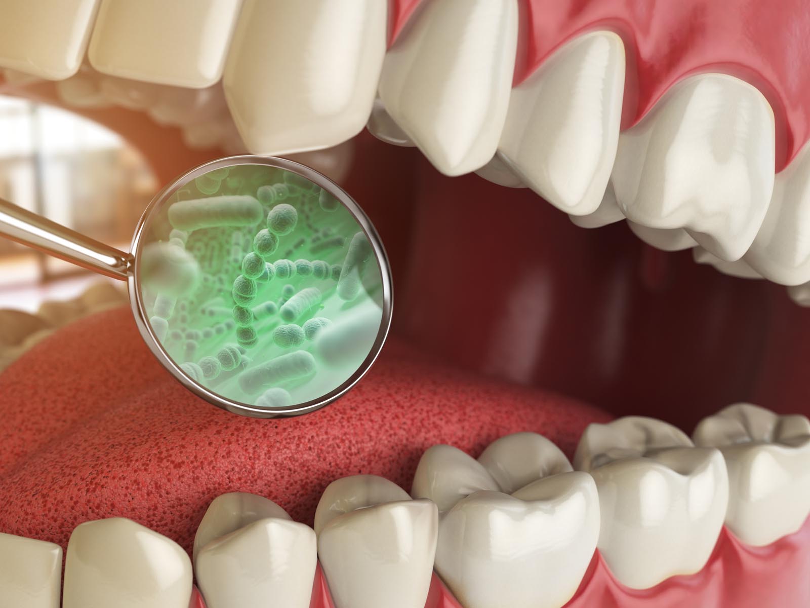 Bad Breath Treatment